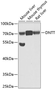 DNTT Polyclonal Antibody (E-AB-61854)