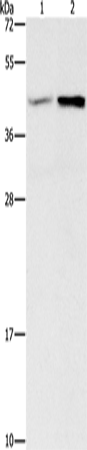 GNB5 Polyclonal Antibody (E-AB-14091)