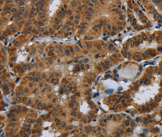 Glucocorticoid Receptor Polyclonal Antibody (E-AB-11270)