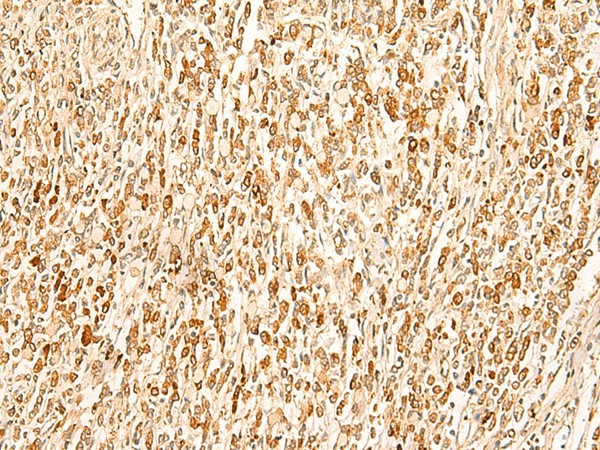 SMUG1 Polyclonal Antibody (E-AB-52829)