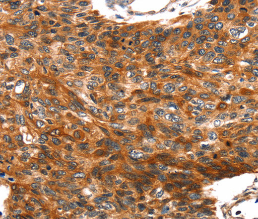 TRIM69 Polyclonal Antibody (E-AB-15360)