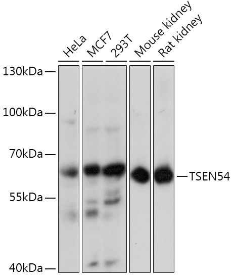 TSEN54 Polyclonal Antibody (E-AB-91074)
