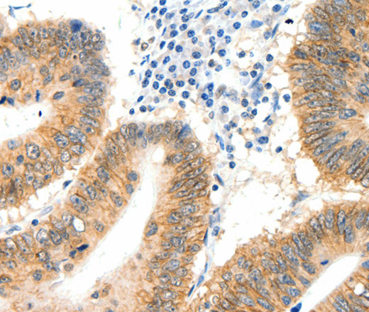 SIPA1 Polyclonal Antibody (E-AB-16071)