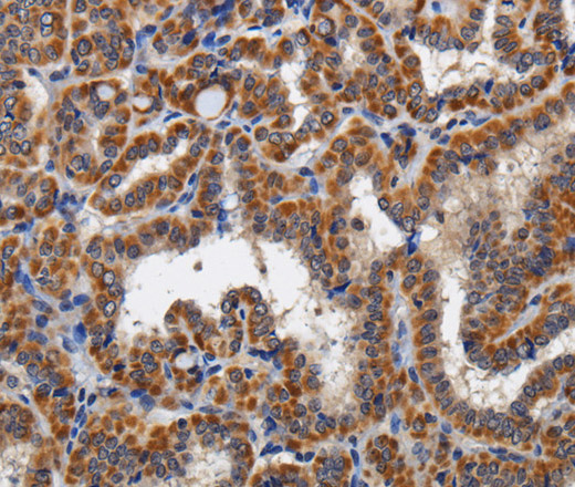 KLK6 Polyclonal Antibody (E-AB-11356)