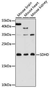 SDHD Polyclonal Antibody (E-AB-91480)