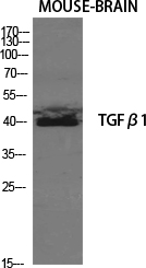 TGFB1 Polyclonal Antibody (E-AB-33090)