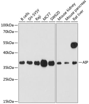 AIP Polyclonal Antibody (E-AB-64239)