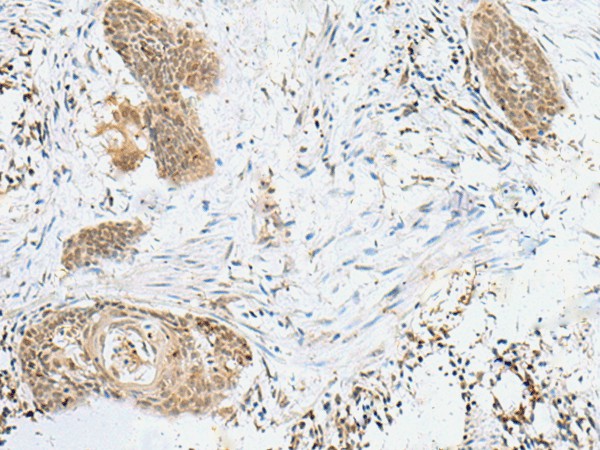 LPXN Polyclonal Antibody (E-AB-18825)