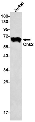 Recombinant Chk2 Monoclonal Antibody (E-AB-81546)