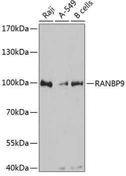 RANBP9 Polyclonal Antibody (E-AB-63625)