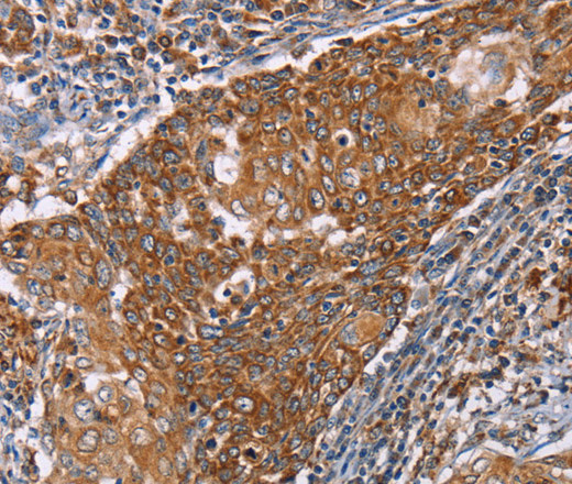 PMPCB Polyclonal Antibody (E-AB-15304)