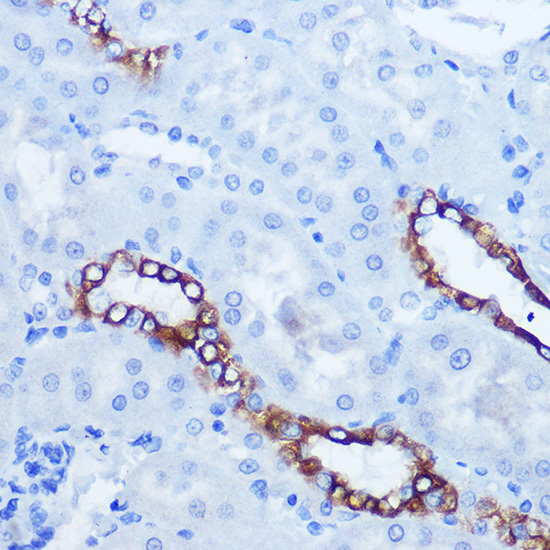EPHA3/EPHA4/EPHA5 Polyclonal Antibody (E-AB-92205)