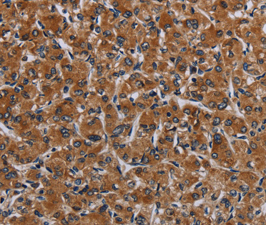 IRGM Polyclonal Antibody (E-AB-11336)