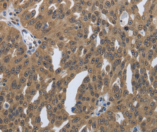 PRKAR1B Polyclonal Antibody (E-AB-16033)