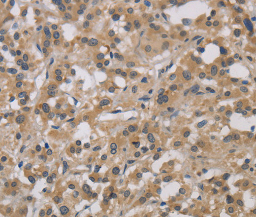 DCN Polyclonal Antibody (E-AB-14035)