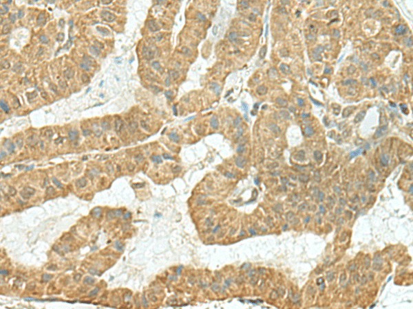 TENT5C Polyclonal Antibody (E-AB-19018)