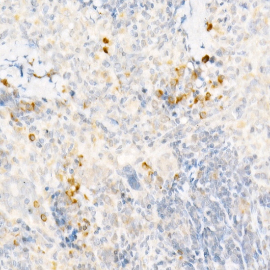 MCP-1 Polyclonal Antibody (E-AB-68402)