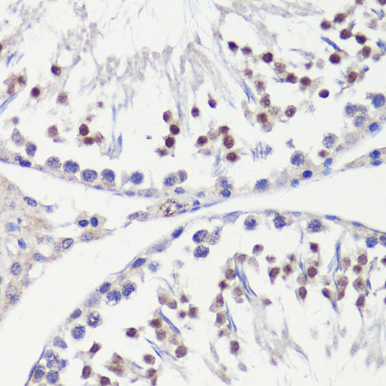 HFM1 Polyclonal Antibody (E-AB-62578)