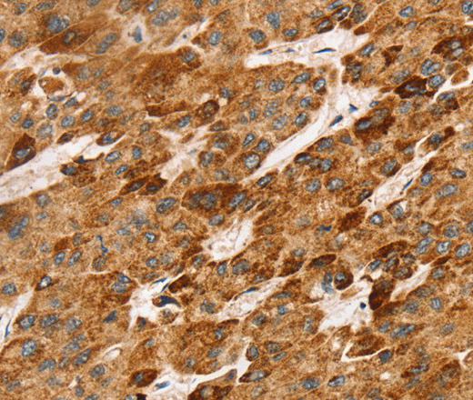 LTB Polyclonal Antibody (E-AB-13743)