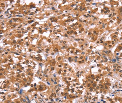 AMER1 Polyclonal Antibody (E-AB-16424)
