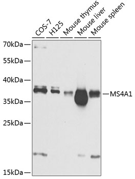 MS4A1 Polyclonal Antibody (E-AB-62658)