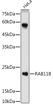 RAB11B Polyclonal Antibody (E-AB-91129)