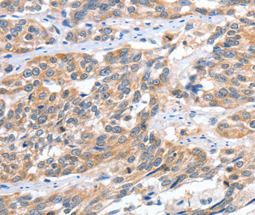 CGB Polyclonal Antibody (E-AB-11077)