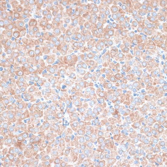 PMEPA1 Polyclonal Antibody (E-AB-66851)