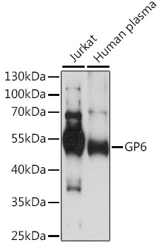 GP6 Polyclonal Antibody (E-AB-91027)