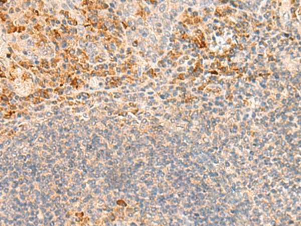 GRM2 Polyclonal Antibody (E-AB-53395)