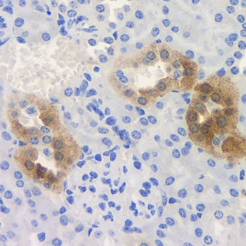 ROCK1 Polyclonal Antibody (E-AB-70124)