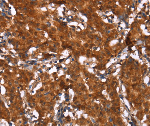 HCAR2 Polyclonal Antibody (E-AB-16467)