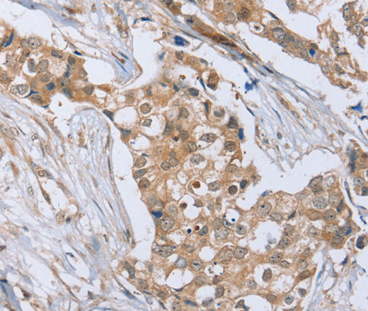 RAB8B Polyclonal Antibody (E-AB-13546)