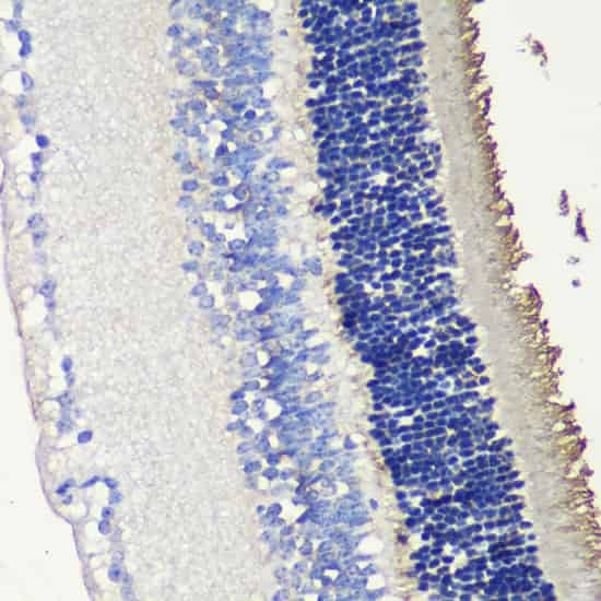 SAG Polyclonal Antibody (E-AB-65995)