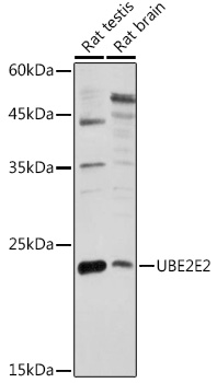 UBE2E2 Polyclonal Antibody (E-AB-91527)