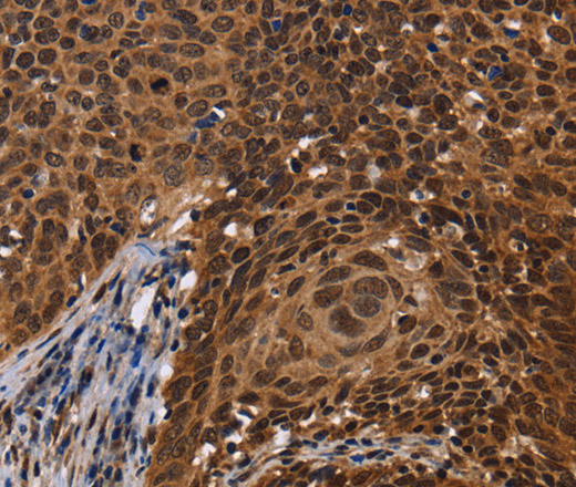 FASTKD5 Polyclonal Antibody (E-AB-15021)