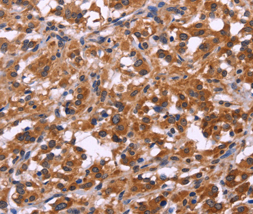 SPATA7 Polyclonal Antibody (E-AB-10625)