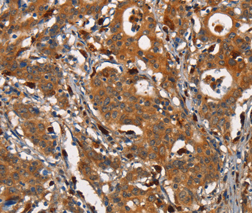 CEACAM3 Polyclonal Antibody (E-AB-15979)