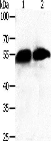GC Polyclonal Antibody (E-AB-10680)