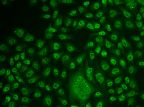 TFPT Polyclonal Antibody (E-AB-61981)