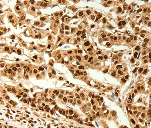 C12orf5 Polyclonal Antibody (E-AB-16101)