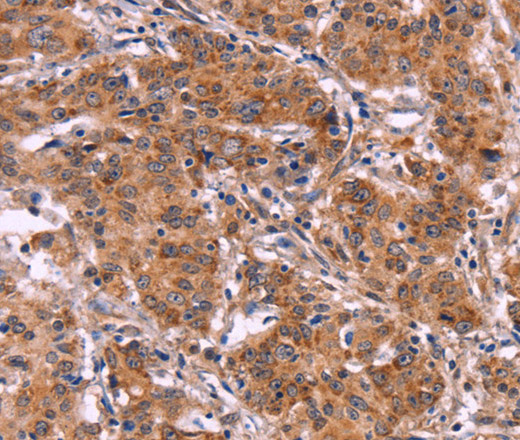 MMP14 Polyclonal Antibody (E-AB-14218)