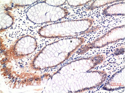 Phospho-MLKL (Ser358) Monoclonal Antibody (E-AB-21338)