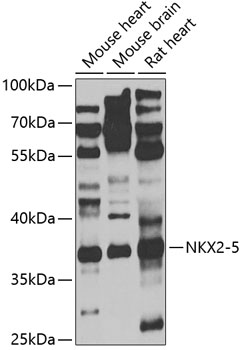 NKX2-5 Polyclonal Antibody (E-AB-68374)