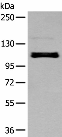 ZNF281 Polyclonal Antibody (E-AB-18446)