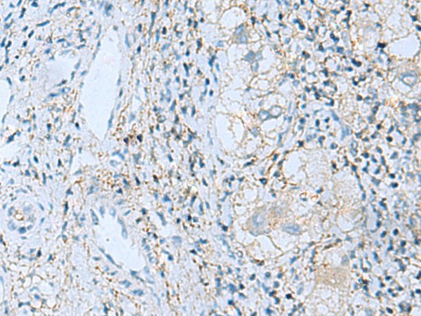 EMILIN1 Polyclonal Antibody (E-AB-53161)
