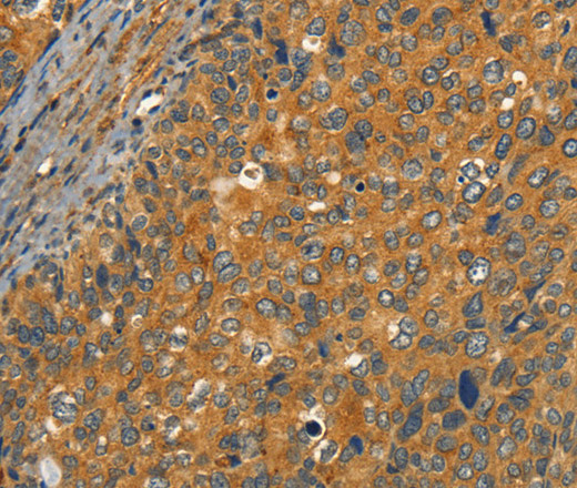 CIB1 Polyclonal Antibody (E-AB-13150)