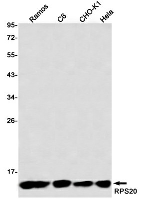 Recombinant RPS20 Monoclonal Antibody (E-AB-81509)
