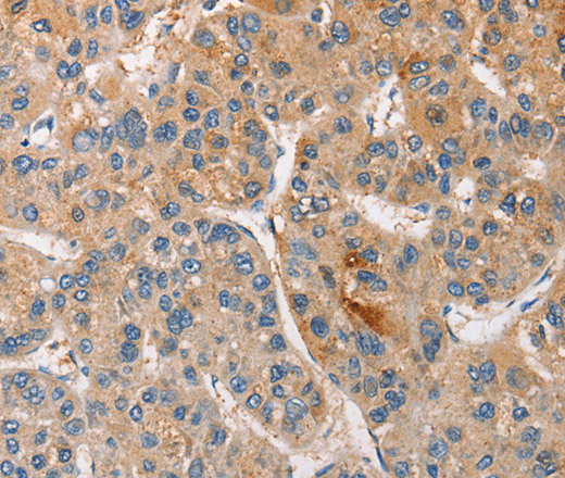 CCL4 Polyclonal Antibody (E-AB-13983)