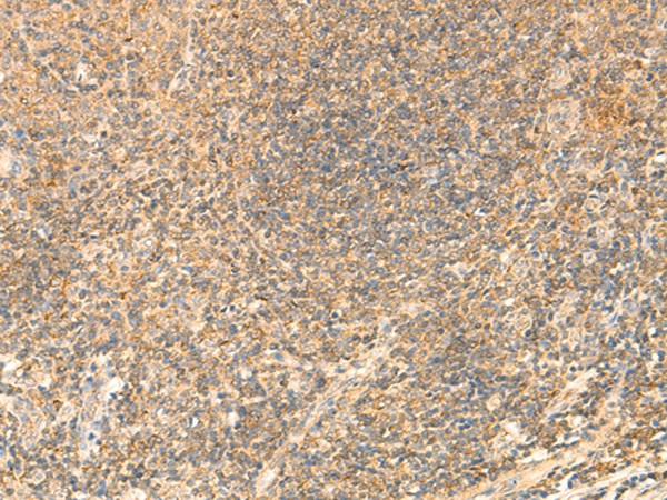 PDAP1 Polyclonal Antibody (E-AB-18922)